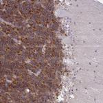 GPRIN3 Polyclonal Antibody