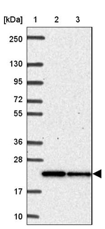 MRPL11 Antibody in Western Blot (WB)
