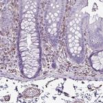 TMEM86B Antibody in Immunohistochemistry (Paraffin) (IHC (P))