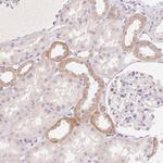 CLCNKA Polyclonal Antibody