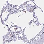 Lymphotactin Antibody in Immunohistochemistry (Paraffin) (IHC (P))