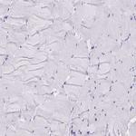 Lymphotactin Antibody in Immunohistochemistry (Paraffin) (IHC (P))