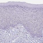 Lymphotactin Antibody in Immunohistochemistry (Paraffin) (IHC (P))