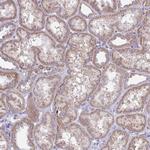PLA2G12B Antibody in Immunohistochemistry (Paraffin) (IHC (P))