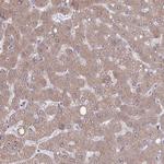 PLA2G12B Antibody in Immunohistochemistry (Paraffin) (IHC (P))