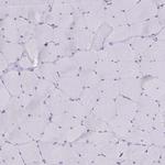 PLA2G12B Antibody in Immunohistochemistry (Paraffin) (IHC (P))