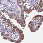 PLA2G12B Polyclonal Antibody