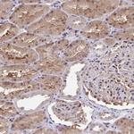 C5orf24 Antibody in Immunohistochemistry (Paraffin) (IHC (P))