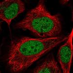 C5orf24 Polyclonal Antibody