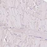 CYP11B2 Antibody in Immunohistochemistry (IHC)