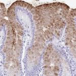 GKN2 Antibody in Immunohistochemistry (Paraffin) (IHC (P))