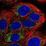 COA5 Polyclonal Antibody