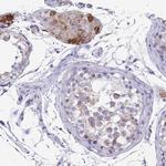 COA5 Antibody in Immunohistochemistry (Paraffin) (IHC (P))