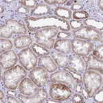 COA5 Antibody in Immunohistochemistry (Paraffin) (IHC (P))