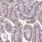 COA5 Antibody in Immunohistochemistry (Paraffin) (IHC (P))