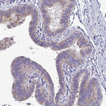 COA5 Antibody in Immunohistochemistry (Paraffin) (IHC (P))