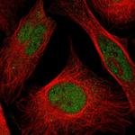 HEAB Polyclonal Antibody