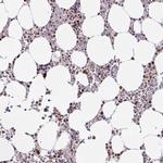 HEAB Antibody in Immunohistochemistry (Paraffin) (IHC (P))