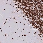 HEAB Antibody in Immunohistochemistry (Paraffin) (IHC (P))