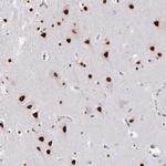 HEAB Antibody in Immunohistochemistry (Paraffin) (IHC (P))