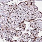 HEAB Antibody in Immunohistochemistry (Paraffin) (IHC (P))