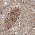 GNG7 Antibody in Immunohistochemistry (IHC)