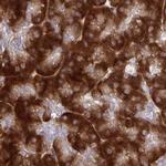 RPS15 Antibody in Immunohistochemistry (IHC)