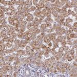 ZNF644 Antibody in Immunohistochemistry (Paraffin) (IHC (P))