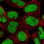 DEK Polyclonal Antibody