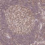 DEK Antibody in Immunohistochemistry (Paraffin) (IHC (P))