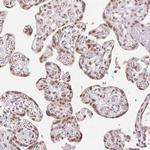 DEK Antibody in Immunohistochemistry (Paraffin) (IHC (P))