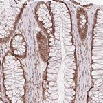 DEK Antibody in Immunohistochemistry (Paraffin) (IHC (P))