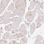 DEK Antibody in Immunohistochemistry (Paraffin) (IHC (P))