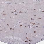 C19orf35 Antibody in Immunohistochemistry (Paraffin) (IHC (P))