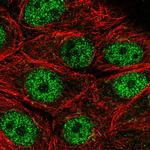 MORN2 Antibody in Immunocytochemistry (ICC/IF)