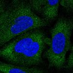 NAA30 Polyclonal Antibody