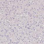 S100A7L2 Antibody in Immunohistochemistry (Paraffin) (IHC (P))