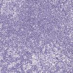 S100A7L2 Antibody in Immunohistochemistry (Paraffin) (IHC (P))