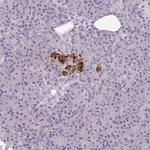 S100A7L2 Antibody in Immunohistochemistry (Paraffin) (IHC (P))