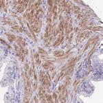 S100A7L2 Polyclonal Antibody