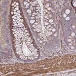 ZNF696 Polyclonal Antibody