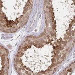 RANGRF Polyclonal Antibody