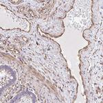 KF1 Polyclonal Antibody