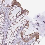 TRAM2 Polyclonal Antibody