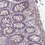 C1orf165 Polyclonal Antibody