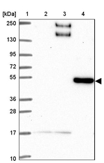 C1orf165 Antibody in Western Blot (WB)