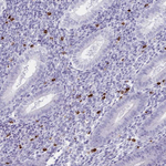 Granulysin Polyclonal Antibody