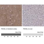 PEX5L Polyclonal Antibody