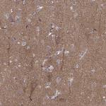 PEX5L Antibody in Immunohistochemistry (IHC)
