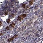 PEX5L Antibody in Immunohistochemistry (IHC)